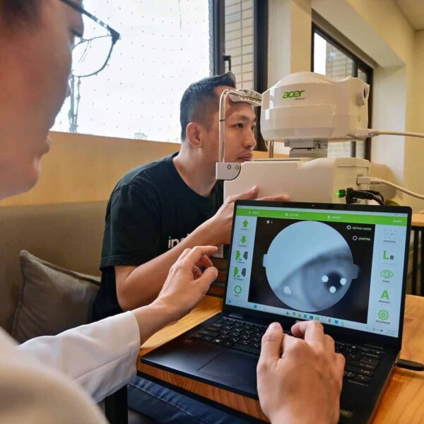 Acer Medical en samenwerking met Intel: Revolutie in Oog- en Botdiagnose met Kunstmatige Intelligentie in Slechts Enkele Sekunden